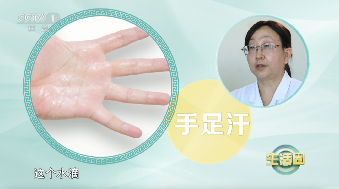 天热出汗多？这4个地方总出汗，小心是身体在报警！