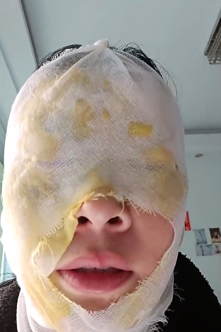 瞬间爆炸！这个生活&ldquo;妙招&rdquo;暗藏危险