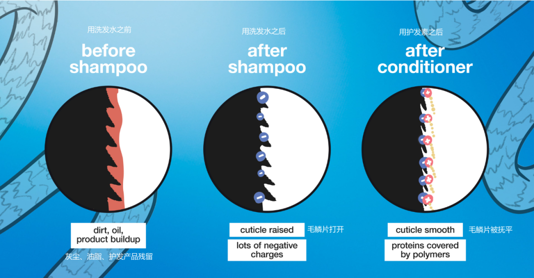 为什么用去屑洗发水，头皮屑反而越洗越多？
